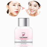 Refining Calamine Pink Spot (Kem Chống Đốm Hồng)