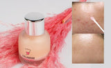 Refining Calamine Pink Spot (Kem Chống Đốm Hồng)