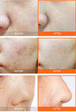 Vitamin C Energy Peeling Gel (Mặt Nạ Cấp Vitamin C)